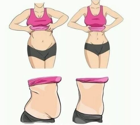 Abdominal weight loss